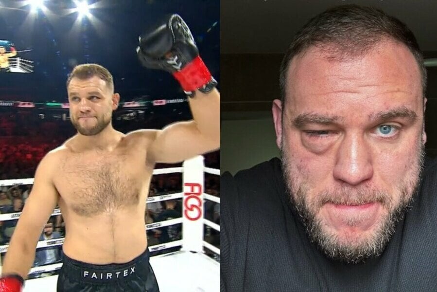 Rimtai sužeistas Mantas Rimdeika: „Deja, liūdnos žinios“ | Sportas.lt